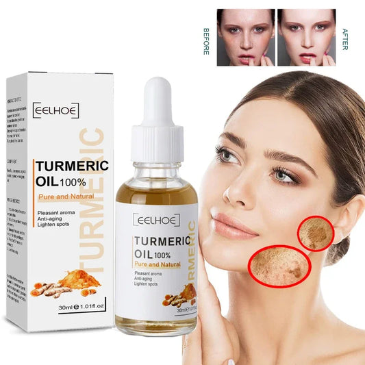 Freckle Remove Turmeric Serum Curcumin Oil Face Whitening Brighten Moisturizing Fade Dark Spot Removal Melaninskin Turmeric Oil
