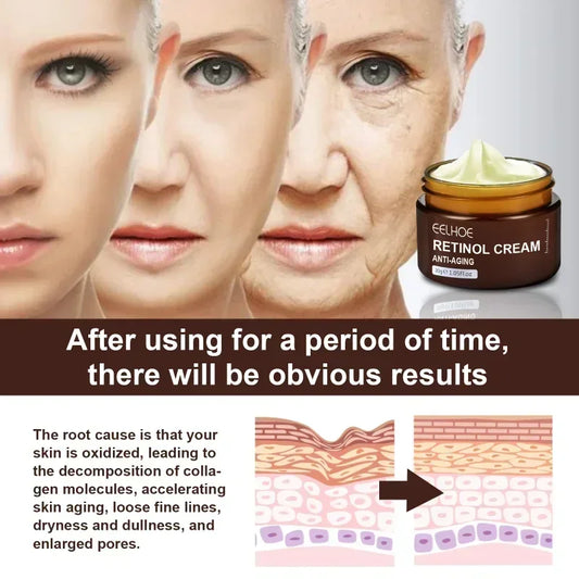 Retinol  Wrinkle Firming skin Lifting Anti-Aging Whitening Cream